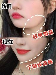 -上海漾颜医疗美容