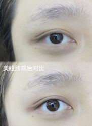 -张小野·专业半永久纹眉