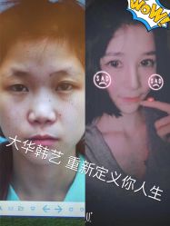 点击看大图 -大华韩艺整形美容医院