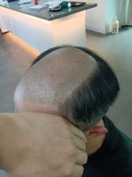 -极客侠男士假发定制补发