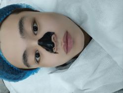 -悟空祛痘·诺奖技术专业店