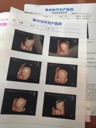 -徐州和平妇产医院·月子中心