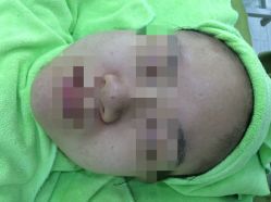 -苗医生草本科技祛痘