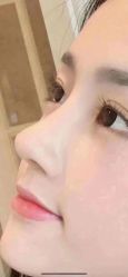 -美莱医学美容医院