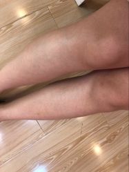 -晶奕空间专业脱毛连锁机构