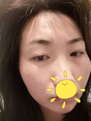 体验后-联合丽格·张菡丽格医疗美容