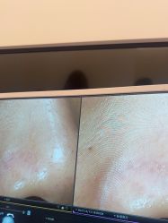 点击看大图 -苑苑vbeauty科技美容SPA