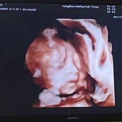 -杭州贝瑞斯美华妇儿医院·早孕·产检·儿科