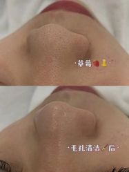 -美肤盾祛痘·问题肌头疗管理中心