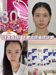 -广州健丽·去眼袋医疗美容机构