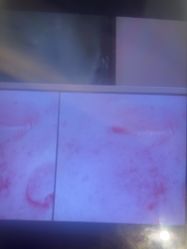 点击看大图 -苑苑vbeauty科技美容SPA