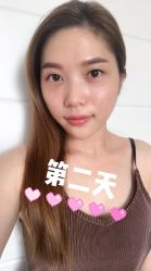 -广州健丽·去眼袋医疗美容机构