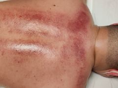 -安琪盲人按摩调理草本熏蒸馆(风和日丽店)