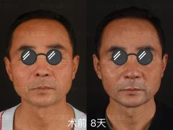 -北京米扬丽格医疗美容·联合丽格鼻整形中心