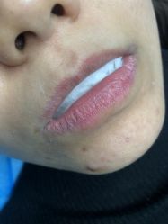 -郡艺医疗美容·微整·眼鼻吸脂