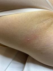 -清疣美疣·痣·斑净肤中心