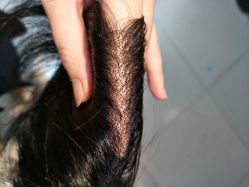 点击看大图 -发饰美男士增发补发假发定制店