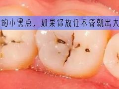 -团圆口腔·种植中心(锦江院区)