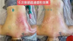 -良咔瘦身·减脂塑形