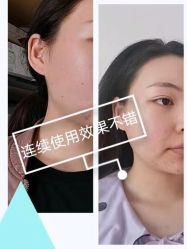-美莱医疗美容医院