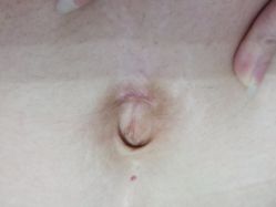 -成都军建医院·疤痕诊疗中心