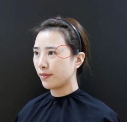 -Yestar 嘉兴艺星医疗美容医院