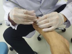 -派恩宜灰指甲鸡眼嵌甲手足癣