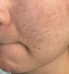 -痘庄科学祛痘国际连锁