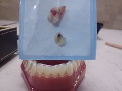 -爱贝口腔·牙周诊疗·种植修复中心