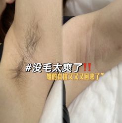 -薇兰专业脱毛连锁机构