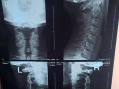 片子.jpg-朱建强诊所