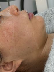 -长沙雅美医疗美容医院