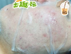 -长沙雅美医疗美容医院