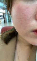 体验后-厦门美莱整形美容医院