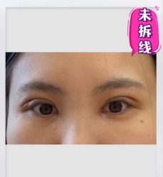 -素美医疗美容·西南眼鼻整形·修复基地