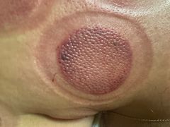 -沈师傅盲人按摩工作室(密三小区店)