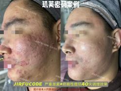 -元熙兰积皮肤管理