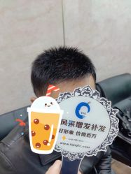 -唐风采假发补发定制