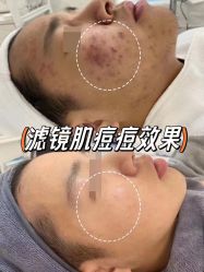 -+MS卓美丝专业祛痘·皮肤管理中心