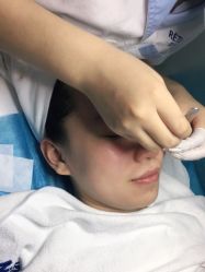 -蕾特恩专业祛痘国际连锁