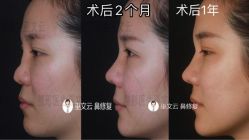 -北京米扬丽格医疗美容·联合丽格鼻整形中心