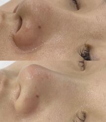 -春田皮肤管理中心品牌旗舰店