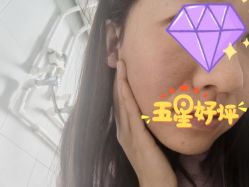 体验后-北京米扬丽格医疗美容·联合丽格鼻整形中心