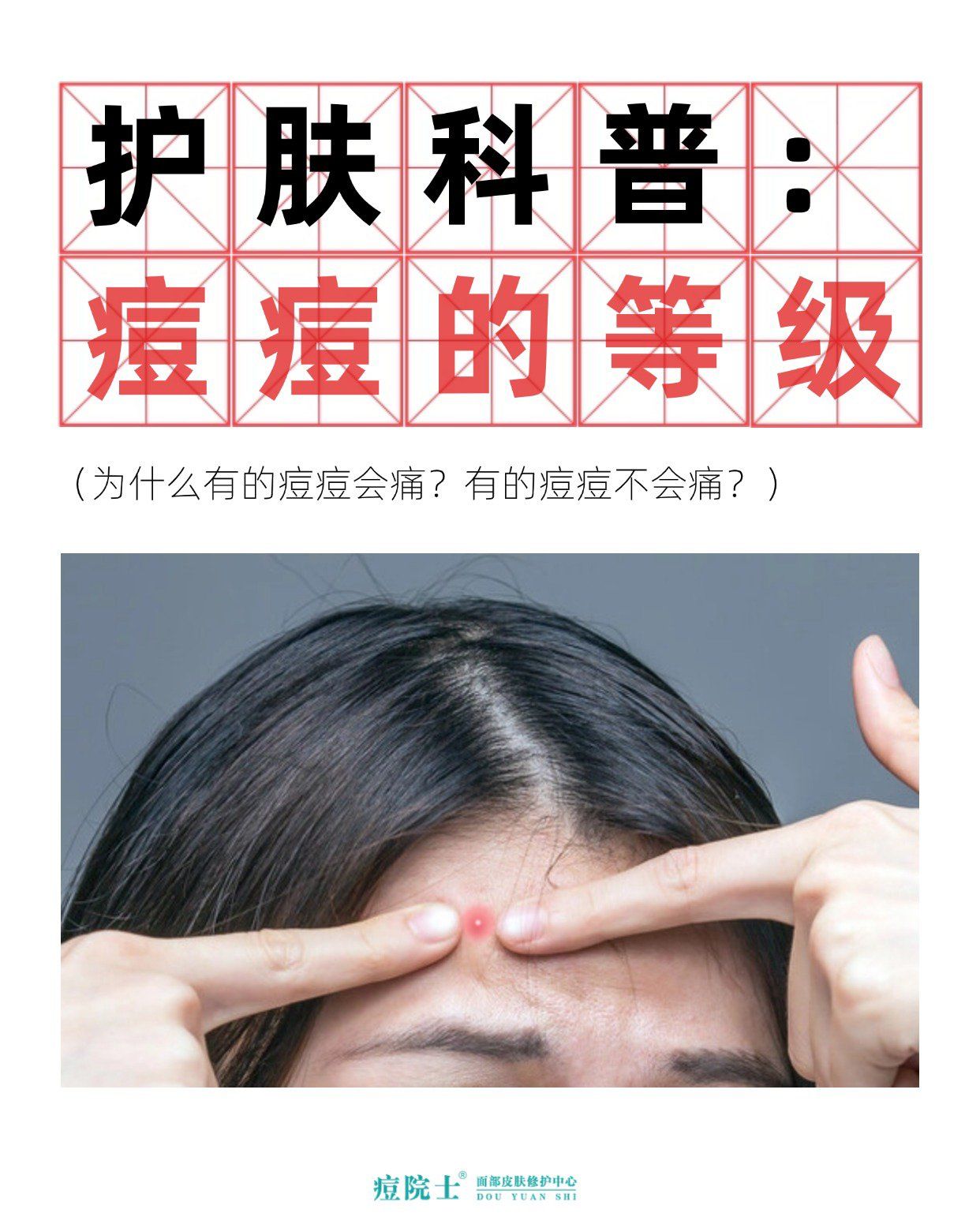 痘痘为什么会痛还会痒百科在线