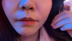 体验后-洁铭新加坡医美