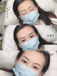 -久匠半永久纹眉