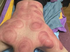 -沈师傅盲人按摩工作室(密三小区店)