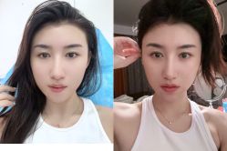 -杭州医巢医疗美容