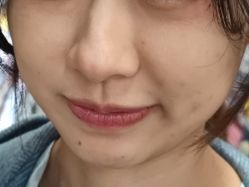 点击看大图 体验前-坤如玛丽·医疗美容中心