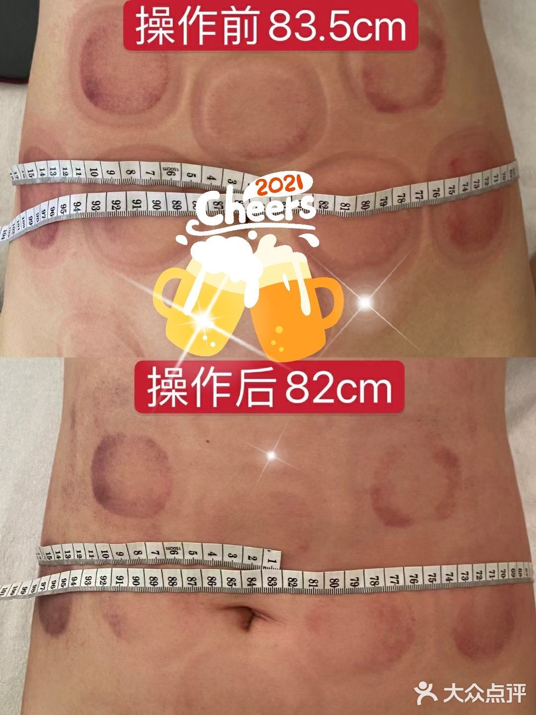 做完后，效果太惊喜啦🌴🌴